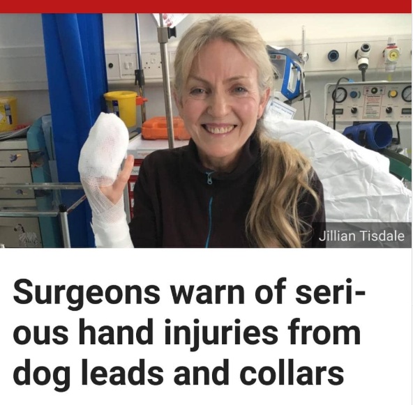 enrollar-correa-mano-no-lo-hagas